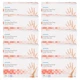 X-LARGE McKesson Vinyl Exam Glove Standard Cuff Length 1 CASE- 10 BOXES